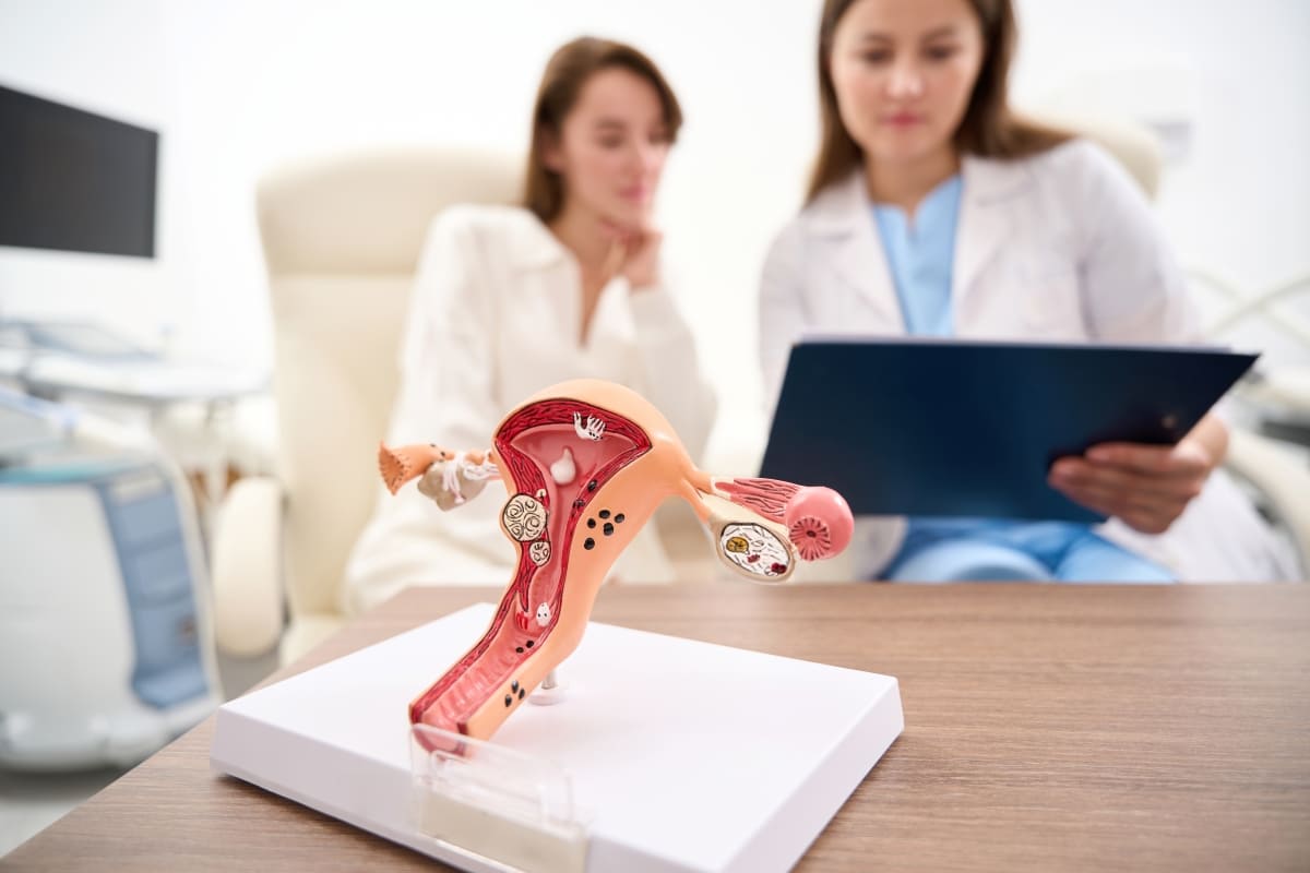 PCOS