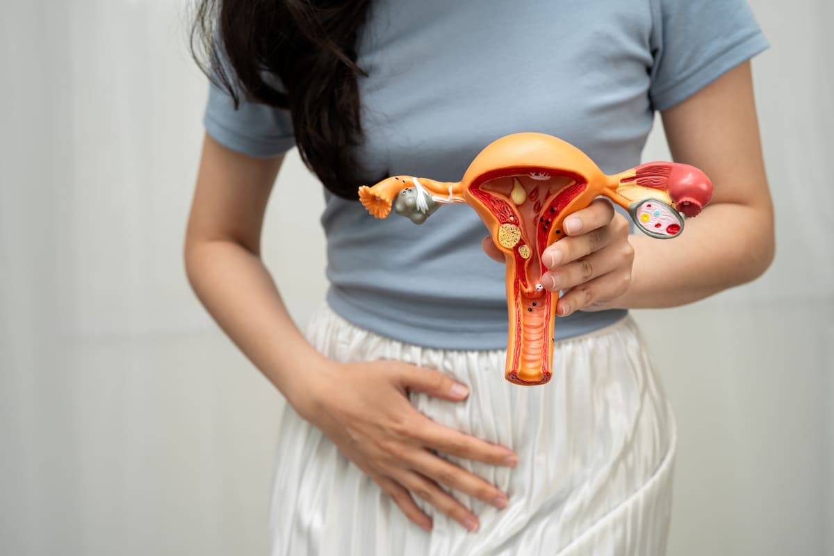 PCOS